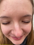 Bildchen